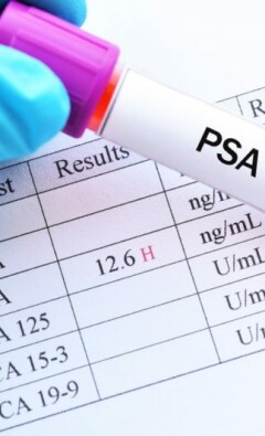 Что такое PSA?