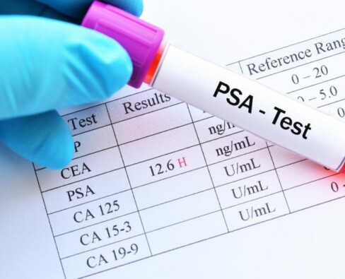 Что такое PSA?