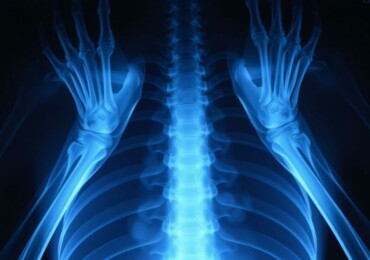 Рентген без страха: понятный и живой гид по лучам, снимкам и безопасности