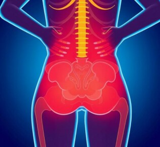 Геморрой: что это такое и как жить с этим заболеванием