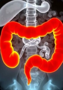 ¿Antibioterapia sola para la apendicitis no complicada? Una conversación honesta sobre una opción en evolución