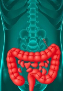 Die Geschichte der Appendizitis-Diagnose: un viaje desde la sospecha hasta la imagen