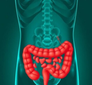 Die Geschichte der Appendizitis-Diagnose: un viaje desde la sospecha hasta la imagen