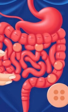 Understanding the Connection Between Appendicitis and Diabetes: What You Need to Know