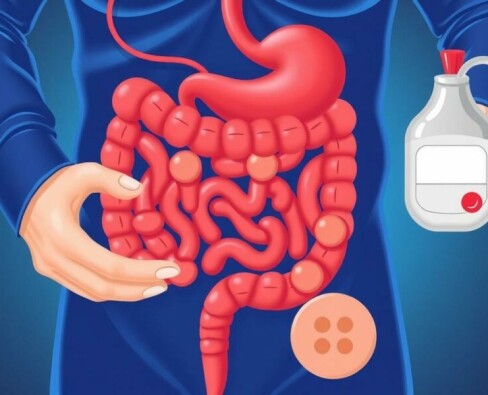 Understanding the Connection Between Appendicitis and Diabetes: What You Need to Know