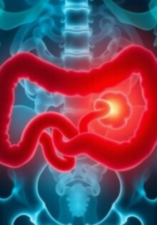 Cuando el dolor no es escuchado: negligencia médica y apendicitis mal diagnosticada