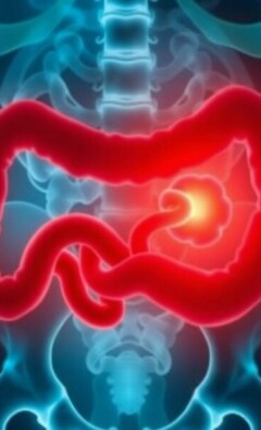 Cuando el dolor no es escuchado: negligencia médica y apendicitis mal diagnosticada