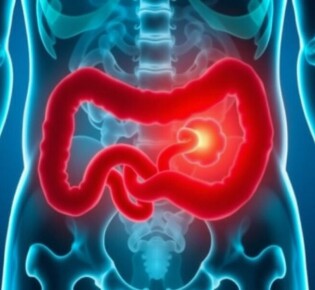 Cuando el dolor no es escuchado: negligencia médica y apendicitis mal diagnosticada
