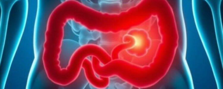 Cuando el dolor no es escuchado: negligencia médica y apendicitis mal diagnosticada