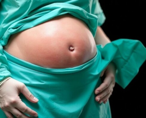 Por qué la apendicitis es la urgencia quirúrgica no obstétrica más común en el embarazo