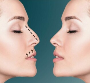 Загрудинный зоб: причины, симптомы и лечение