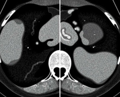 Inteligencia artificial y apendicitis: cómo las TC están cambiando el diagnóstico