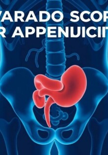 Understanding the Alvarado Score for Appendicitis: A Simple Tool with Big Impact