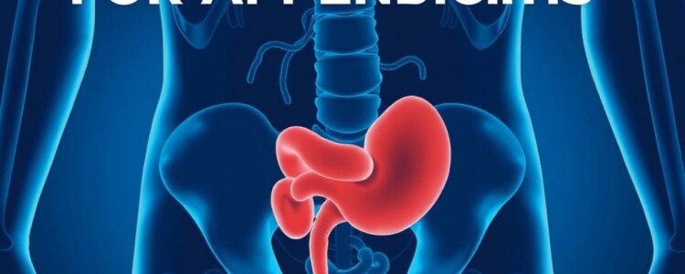 Understanding the Alvarado Score for Appendicitis: A Simple Tool with Big Impact