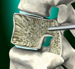 Обыкновенная чечевица: маленькие бобовые с большими секретами