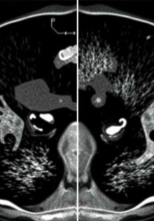 Ultraschall oder CT – was ist besser zur Diagnose?