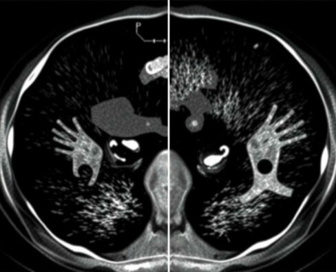 Ultraschall oder CT – was ist besser zur Diagnose?