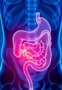 Fieber als Symptom der Appendizitis: Ein lebensrettender Indikator erkennen