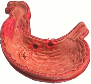 Тайны лесных голубей: увлекательный мир пернатых обитателей
