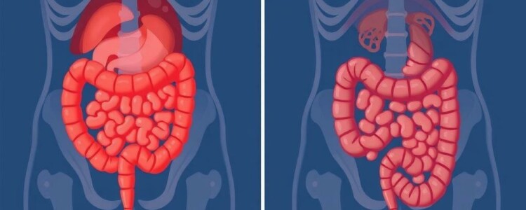 Acute vs. Chronic Appendicitis: Understanding the Differences and What They Mean for You