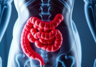 Appendicite et Régime Alimentaire Postopératoire : Comprendre et Bien Se Nourrir pour Favoriser la Guérison