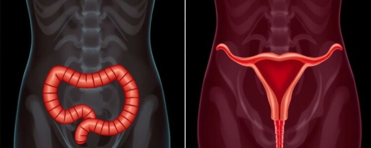 Appendizitis vs. Adnexitis (Eierstockentzündung): cómo distinguir dos dolores que confunden y qué hacer