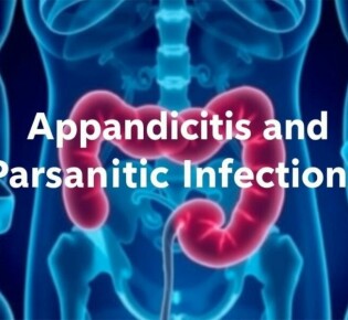 Appendicitis and Parasitic Infections: Exploring the Hidden Connection