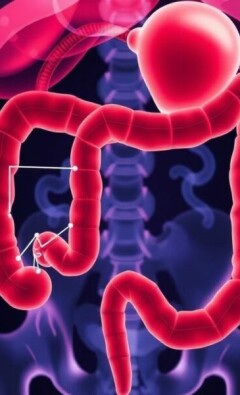 Differential Diagnosis of Appendicitis: Navigating the Maze of Abdominal Pain