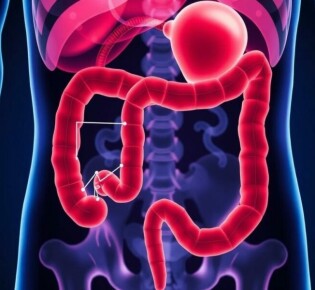 Differential Diagnosis of Appendicitis: Navigating the Maze of Abdominal Pain