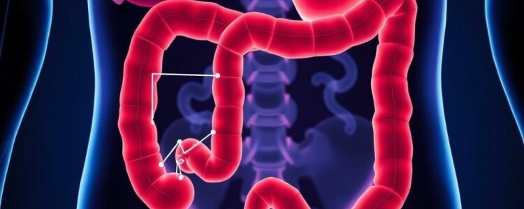Differential Diagnosis of Appendicitis: Navigating the Maze of Abdominal Pain