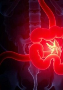 Atypische Appendizitis: Wenn die Symptome täuschen und das Bauchgefühl zählt