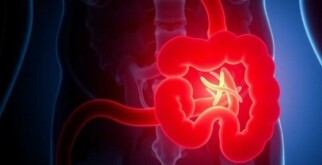 Atypische Appendizitis: Wenn die Symptome täuschen und das Bauchgefühl zählt