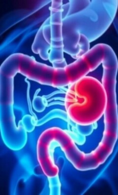 Understanding Appendicitis in Transplant Patients: Challenges, Diagnosis, and Treatment