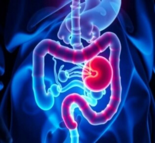 Understanding Appendicitis in Transplant Patients: Challenges, Diagnosis, and Treatment