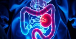 Understanding Appendicitis in Transplant Patients: Challenges, Diagnosis, and Treatment