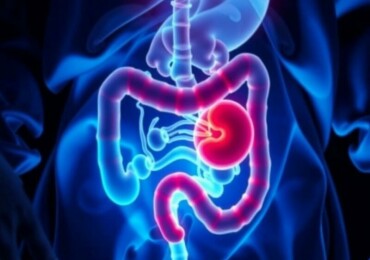 Understanding Appendicitis in Transplant Patients: Challenges, Diagnosis, and Treatment