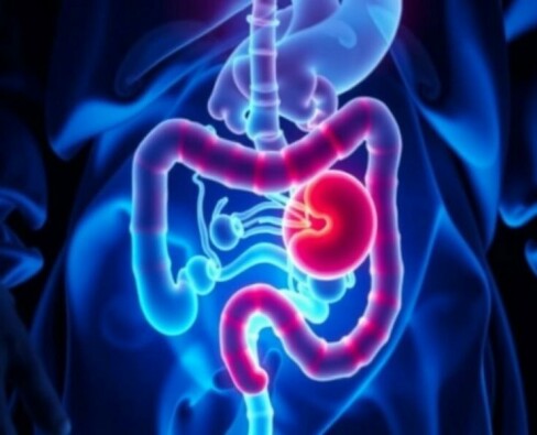 Understanding Appendicitis in Transplant Patients: Challenges, Diagnosis, and Treatment