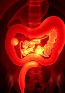 L’appendicite chez le patient âgé: un diagnóstico a menudo retrasado — por qué importa y cómo cambiar la historia