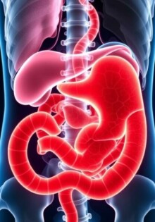 Cáncer de apéndice: una enfermedad rara pero seria que merece tu atención