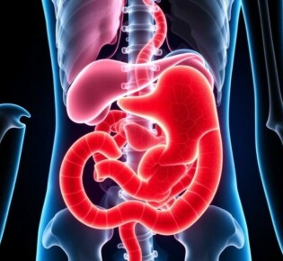 Cáncer de apéndice: una enfermedad rara pero seria que merece tu atención