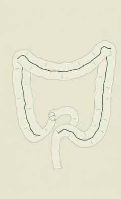 El apéndice: ¿un vestigio inútil o un héroe escondido del intestino?
