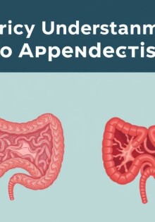 Historical Understanding of Appendicitis: From Ancient Theories to Modern Insights