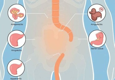Appendicite : Examens et Tests pour le Diagnostic