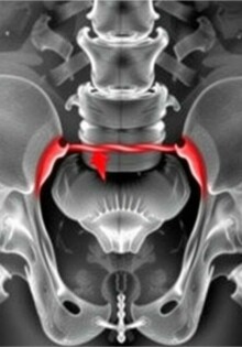 Understanding the Obturator Sign in Appendicitis: A Key Diagnostic Clue