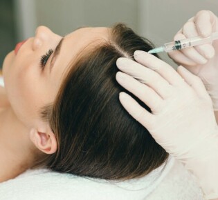 Что такое мезотерапия волосистой части головы?