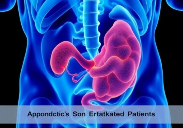Understanding Appendicitis in Immunocompromised Patients: Challenges and Care