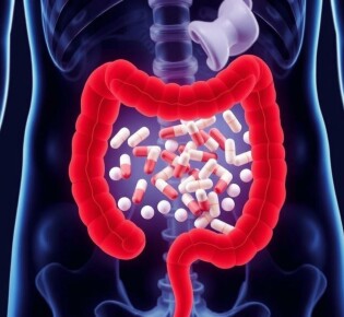 Antibiotics for Appendicitis: A Modern Approach to Treatment