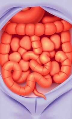 Apendicitis en el niño: claves epidemiológicas y matices clínicos que cambian la historia