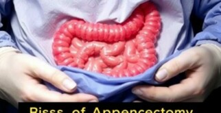 Understanding the Risks of Appendectomy: What You Need to Know