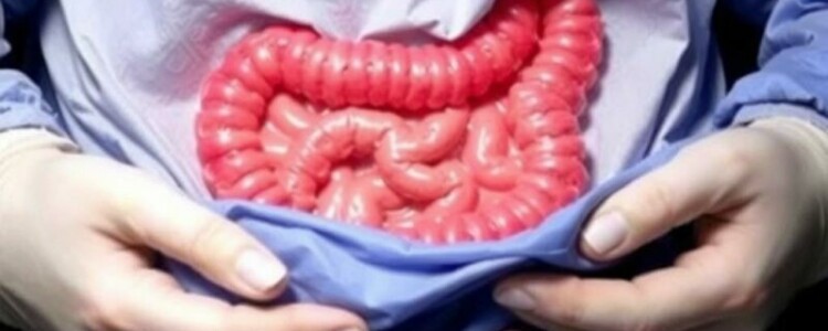Understanding the Risks of Appendectomy: What You Need to Know